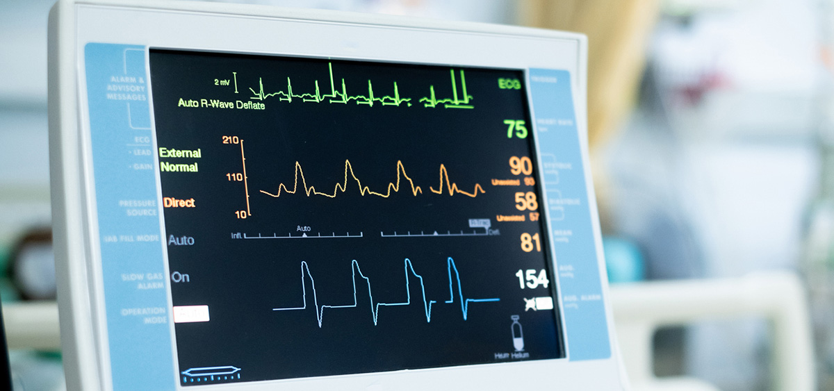 Warum Geräte zur Atemluftüberwachung auf KNF Pumpen vertrauen 