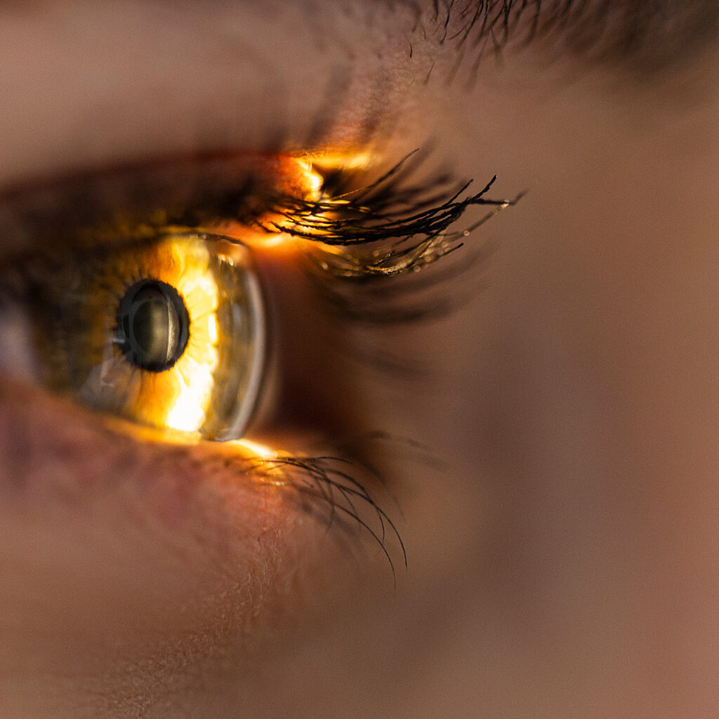 近距离拍摄光线照射下的眼睛特写，该场景有时是白内障手术等医疗应用的一部分。
