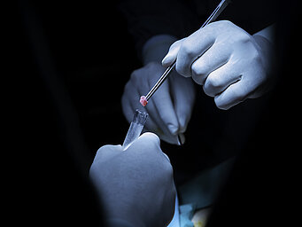 Doctor wearing blue gloves placing a biopsy sample from a needle into a tube for testing.