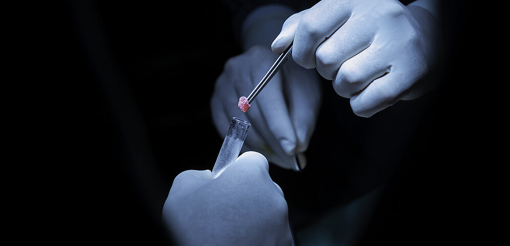 Doctor wearing blue gloves placing a biopsy sample from a needle into a tube for testing.