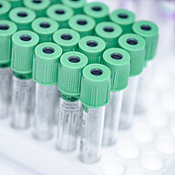 Green capped lab tubes in a tray.